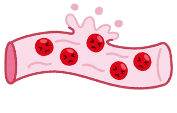 破れた血管のイラスト